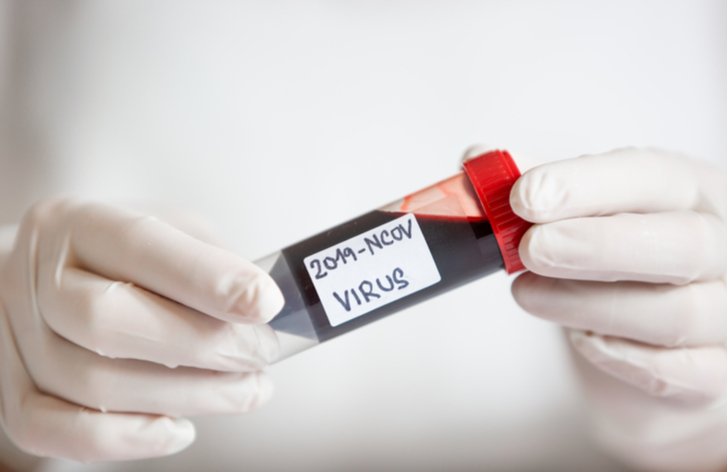 Jak probíhá vyšetření na koronavirus